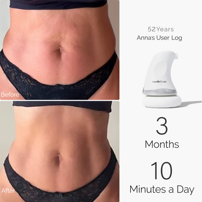 Skin Tightening Bundle Pro™