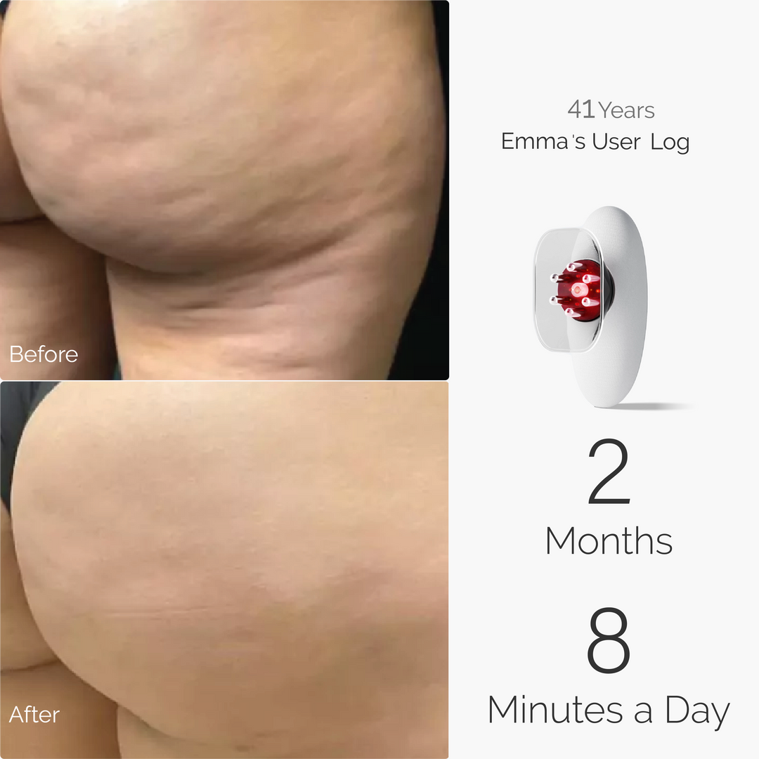 Smooth & Tight All in One Pro™ – Nordic Sculpt