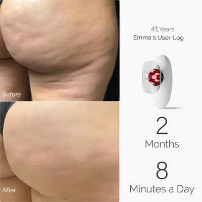 Tone & Smooth Bundle Pro™