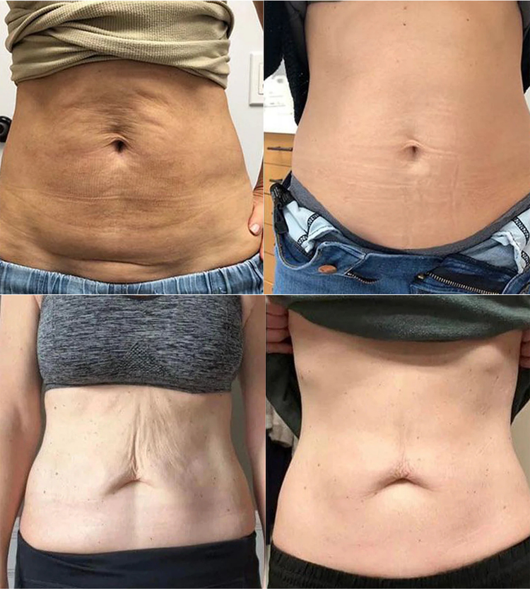 <h2>1. See Results in Weeks, not Months</h2>